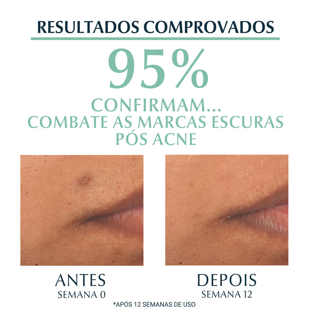 Encontraproduto.com.br - Sérum Facial DermoPure Oil Control Eucerin Com 40ml
