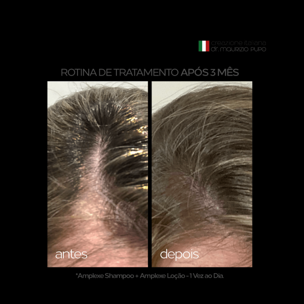 Encontraproduto.com.br - Amplexe Shampoo Antiqueda Ada Tina - Shampoo Antiqueda
