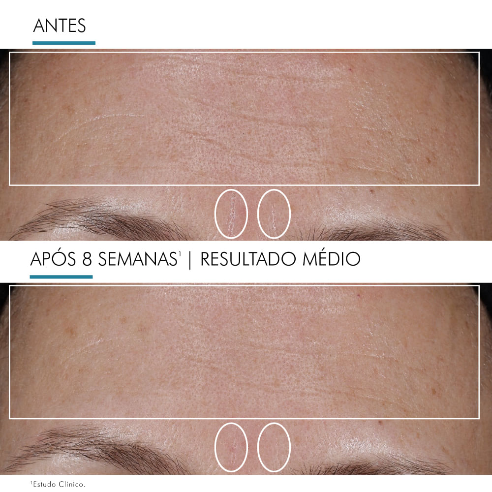 Encontraproduto.com.br - Sérum Booster Skinceuticals Cell Cycle Catalyst Renovador Ce Momento De Aplicação Dia Noite Tipo De Pele Todo Tipo De Pele
