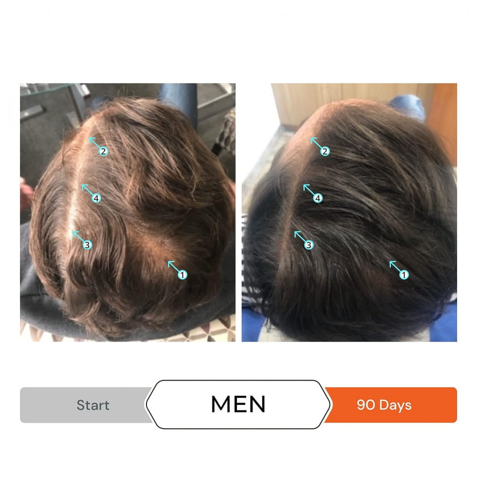 Encontraproduto.com.br - Revita Shampoo e Condicionador 205 ml para Cabelos Finos sem Volume e Espessamento para Homens e Mulheres, DS LABORATORIES, Branco