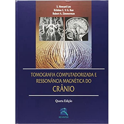 Livro - Tomografia Computadorizada e Ressonância Magnética do Crânio